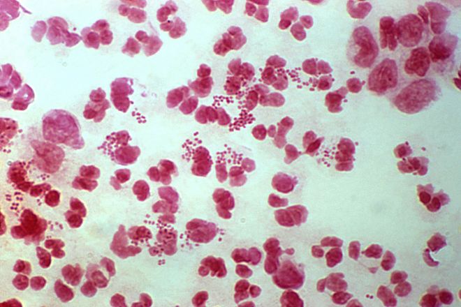 Neisseria gonorrhoeae, the bacterial pathogen that causes gonorrhoea