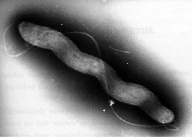 Fig. 2. Electron micrograph of Campylobacter jejuni showing a typical spiral shape of the cell and a long flagellum required for bacterial motility
