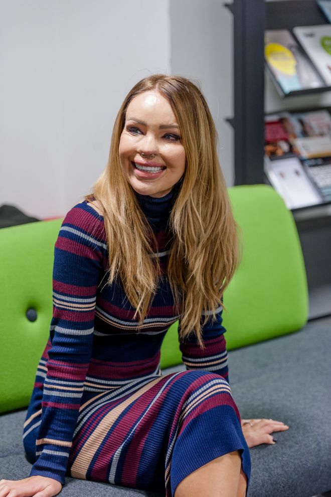 Katie Piper spoke of how disabilities and disfigurements shouldn\\\'t hold people back during a visit to Kingston University