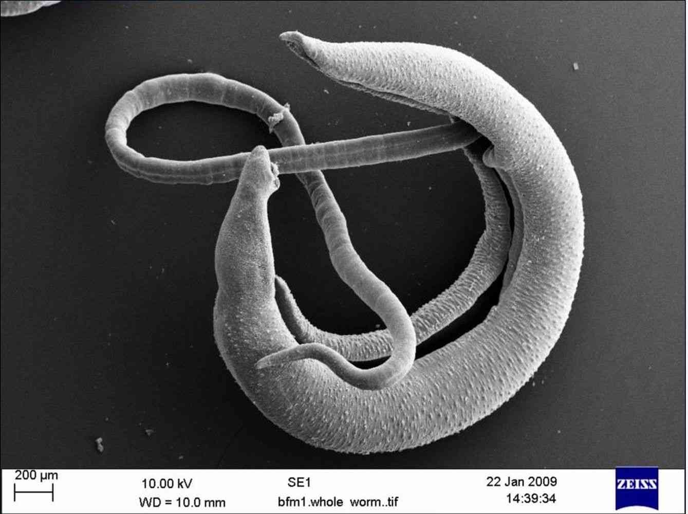 Scanning electron micrograph of Schistosoma bovis - an agent of ruminant schistosomiasis - Hybrid forms of S. bovis-S. haematobium can infect humans and are reported in West Africa and Corsica.