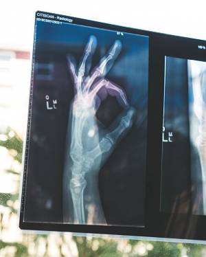 X-ray of hand showing high quality image